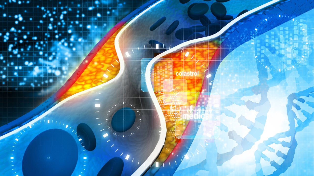 What is Cholesterol? And How to Lower It